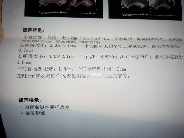 盆腔积液诊断书