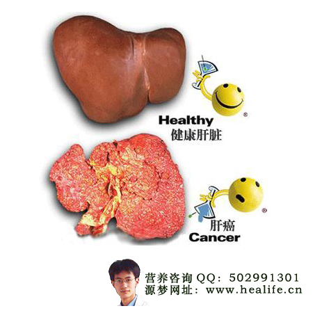 肝炎