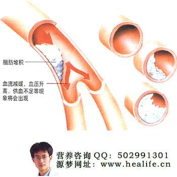 脑出血患者可以有性生活吗?
