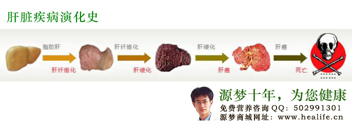 怎样判断是否患有脂肪肝?