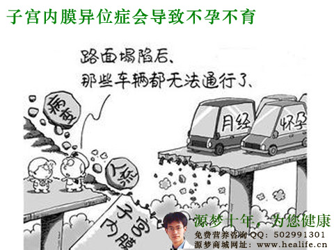 子宫内膜异位症会导致不孕不育