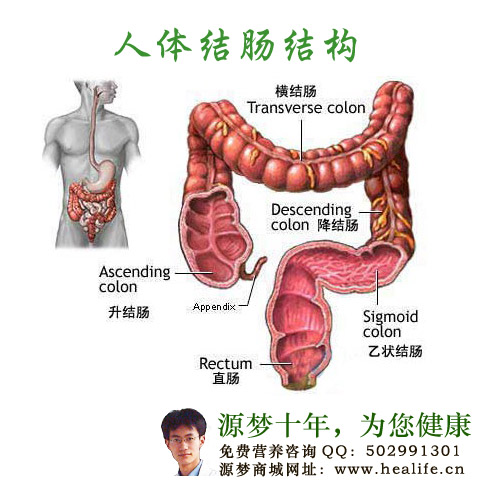 得了结肠癌应该怎么办?