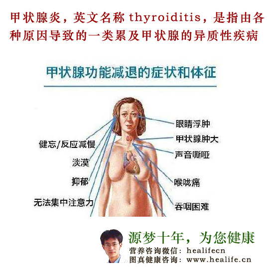 甲状腺炎