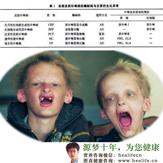 卟啉病
