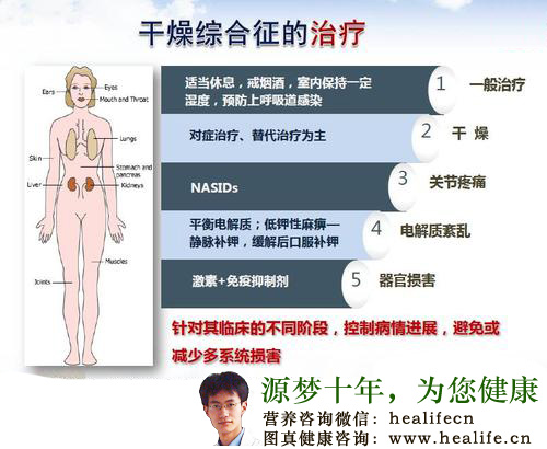 干燥综合征的治疗