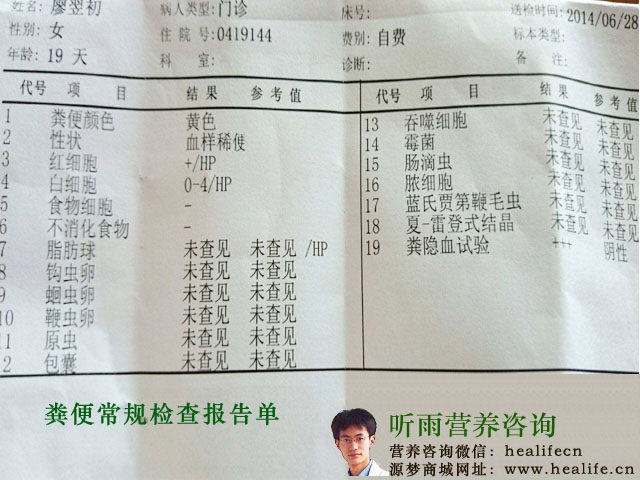 粪便常规检查报告单