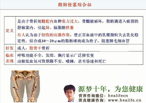 脂肪栓塞综合征的临床表现