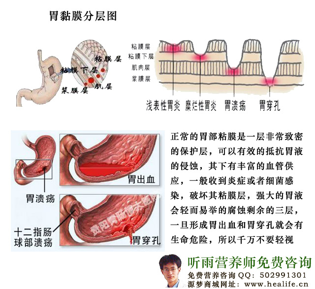 胃溃疡的产生和位置