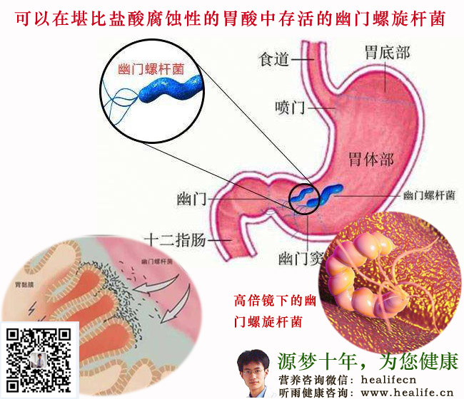 可以在堪比盐酸腐蚀性的胃酸中存活的幽门螺旋杆菌