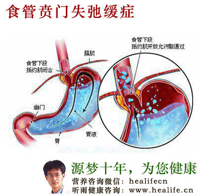 食管贲门失弛缓症