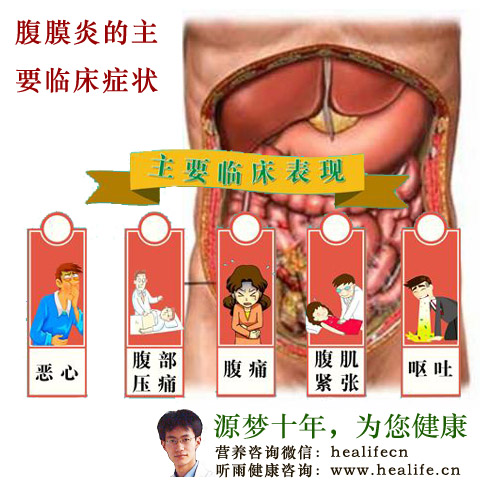 腹膜炎的主要临床症状