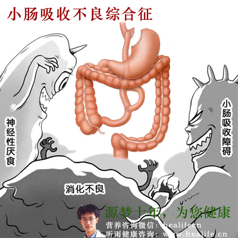 小肠吸收不良综合征
