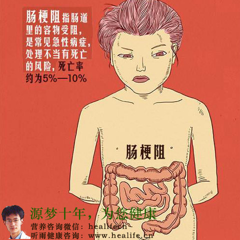 肠梗阻