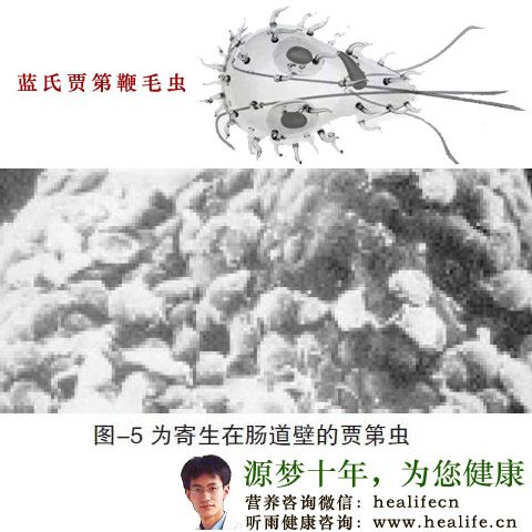 蓝氏贾第鞭毛虫