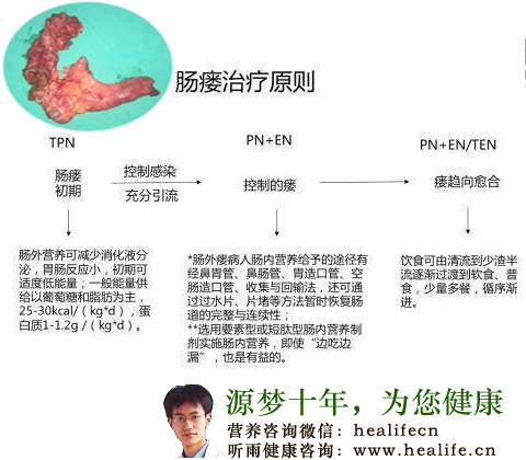 肠篓治疗原则