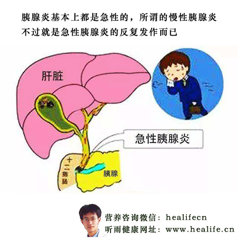急性胰腺炎