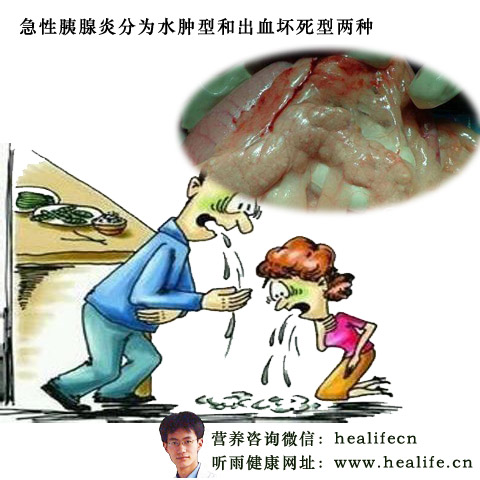 急性胰腺炎分为水肿型和出血坏死型