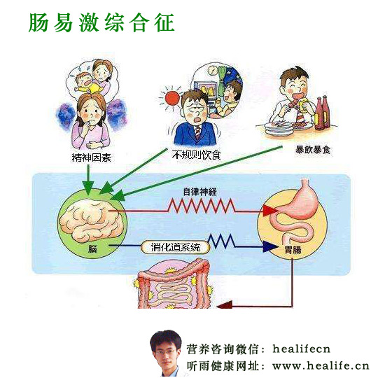 肠易激综合征