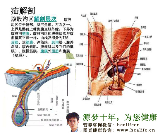 腹股沟疝