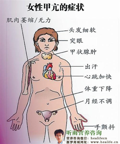 女性甲亢的症状