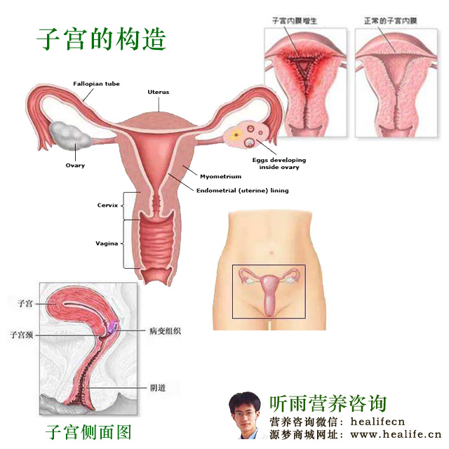 宫颈系列疾病示意图