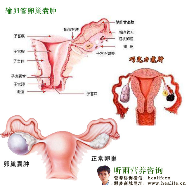 输卵管癌