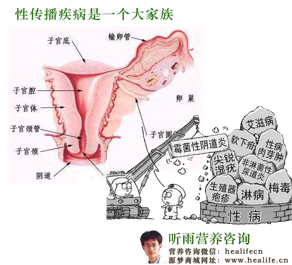 性传播疾病是一个大家族