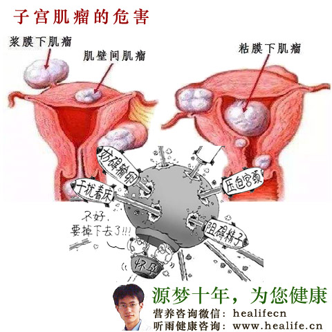 子宫肌瘤的危害