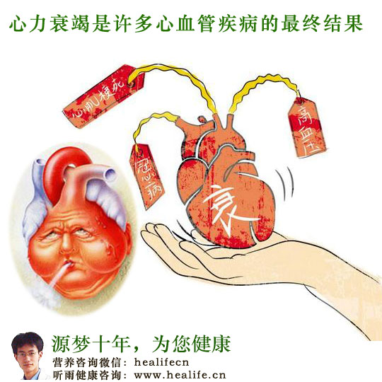 心力衰竭