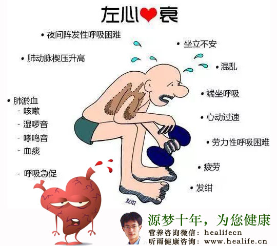 心力衰竭的临床表现都有哪些