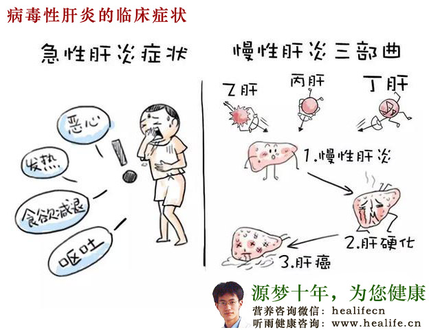 病毒性肝炎的临床症状