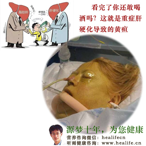肝硬化严不严重