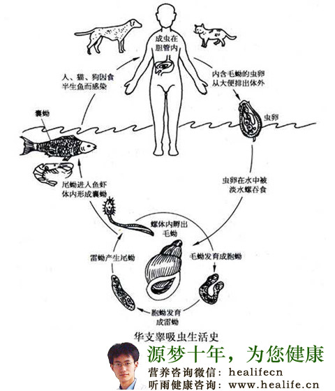 肝吸虫病