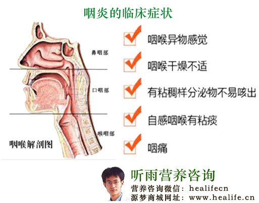 咽炎的临床症状
