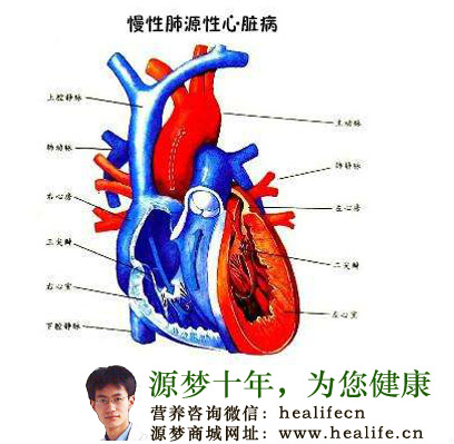 慢性肺源性心脏病