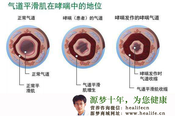 气道平滑肌在哮喘中的地位