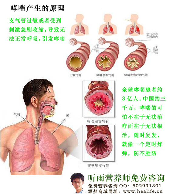 哮喘产生的原理