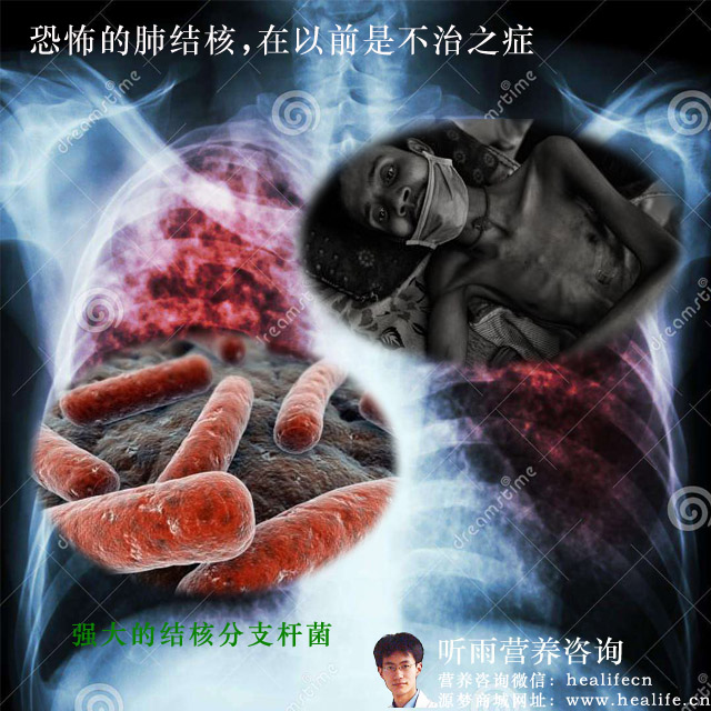 恐怖的肺结核
