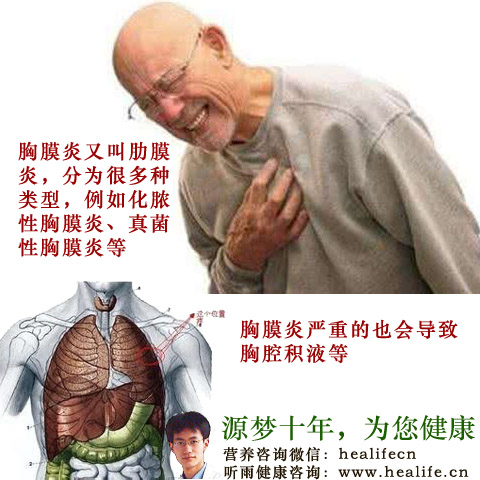 胸膜炎