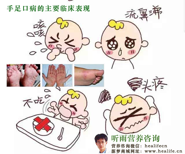 手足口病的主要临床症状