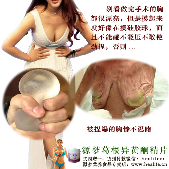 别看隆胸后很漂亮,但是摸着手感很差而且不能压不能捏