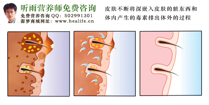 皮肤不断将深嵌入皮肤的脏东西和体内产生的毒素排出体外的过程